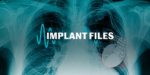 « Implant Files »